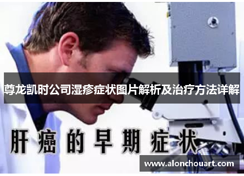 尊龙凯时公司湿疹症状图片解析及治疗方法详解